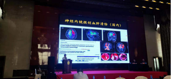 【萊沃醫療】熱烈慶祝中國神經內鏡微創治療高血壓腦出血技術推廣會順利召開